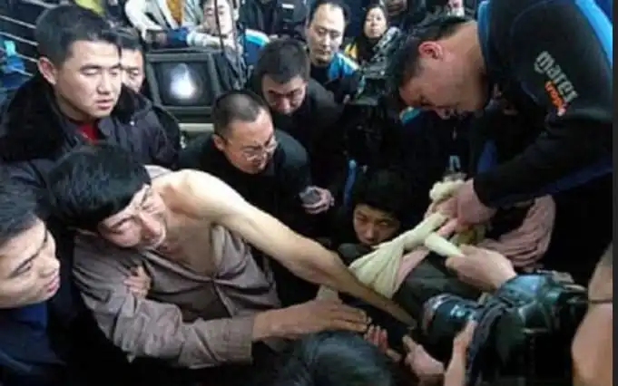 Xi Shun, Yaşama Döndüren Uzun Kollar